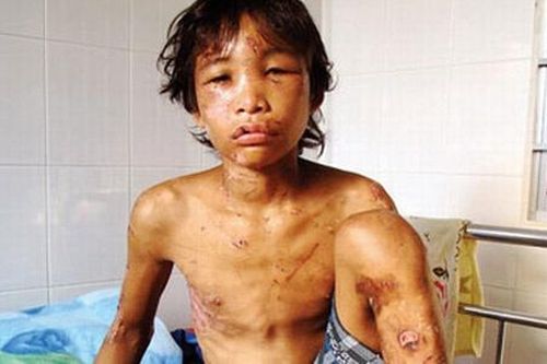 Những vụ bạo hành trẻ em rúng động bị đưa ra xét xử