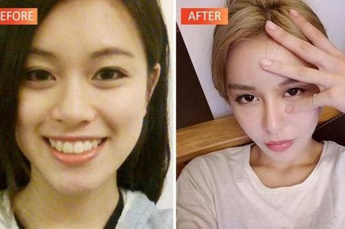 Phẫu thuật thẩm mỹ hàng chục lần để lấy lòng bạn trai