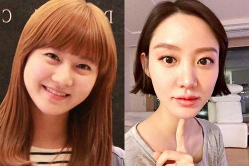 Những sao nữ từng phải hối hận vì phẫu thuật thẩm mỹ