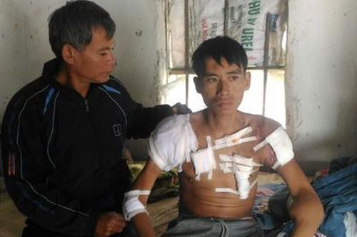Bi đát tình cảnh chàng trai Nghệ An 28 tuổi 10 năm chạy thận