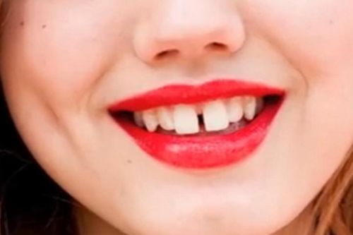 Tránh xa đàn bà có tướng này kẻo hối không kịp