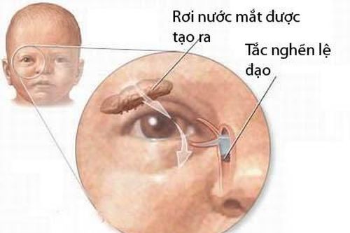 Nếu không muốn hỏng mắt suốt đời, đừng làm những hành động này