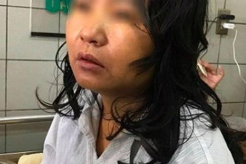 Bác sĩ BV Bạch Mai nói gì về nữ bệnh nhân nguy kịch vì uống thực phẩm chức năng giảm cân?