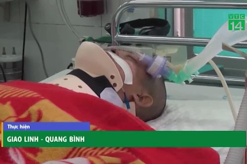 Đuổi theo cướp, người đàn ông bị đạp ngã chấn thương sọ não