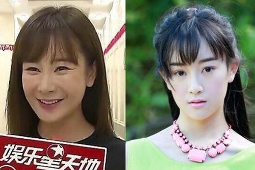 Giai nhân 'Thiên long bát bộ' trở thành thảm họa nhan sắc vì thẩm mỹ