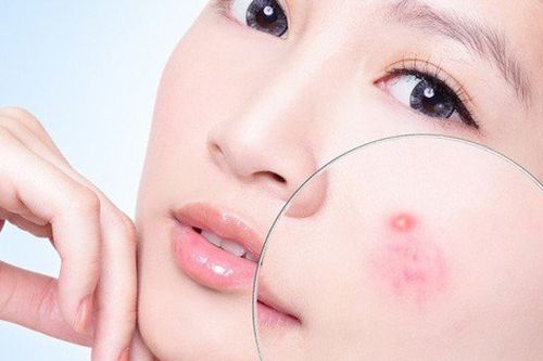 Những sai lầm 'chết người' khiến da mặt bạn ngày càng xấu hơn sau khi đi spa