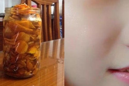 Chuẩn công thức nghệ ngâm mật ong để trắng da sau 2 tuần mà chị em 'phát cuồng'