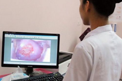 Có phải kiêng chuyện ấy khi bị viêm lộ tuyến cổ tử cung?