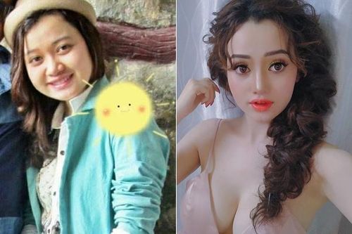 9X sở hữu gương mặt búp bê sau khi chi 100 triệu đồng 'dao kéo'