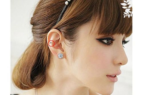 Những nốt ruồi 'đại phú đại quý' ai có thì mở tiệc ngay