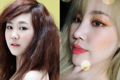 Sao Hàn gây choáng váng với chiếc cằm nhọn, mặt dài khó nhận ra