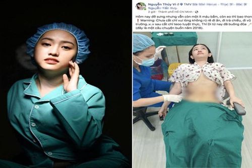 Thúy Vi đăng ảnh vòng bụng thon gọn sau phẫu thuật hút mỡ hết 170 triệu