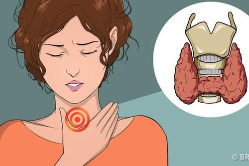 Nếu có những dấu hiệu này, bạn phải đi khám ngay tuyến giáp