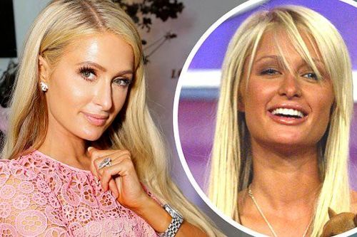 Paris Hilton tiết lộ chưa từng 'dao kéo', dùng kem dưỡng da từ 8 tuổi