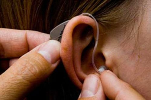 Nữ bác sĩ bị điếc hoàn toàn 2 tai được cứu nhờ kỹ thuật mới
