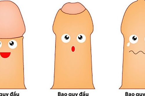Trẻ hẹp bao quy đầu, khi nào nên nong?