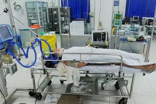 Nữ du khách bất ngờ bị sét đánh khi đang tắm biển