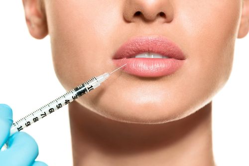 Những điều cần biết khi tiêm filler làm đầy môi