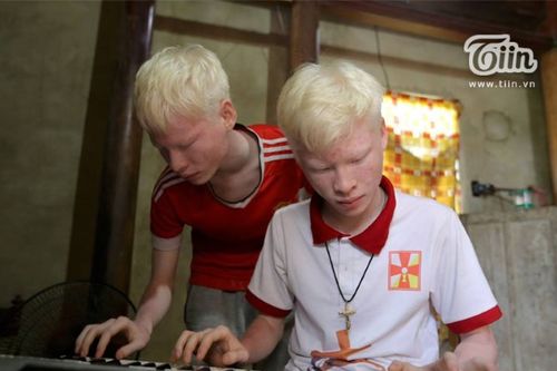 Nghị lực cặp song sinh bạch tạng ở Hà Tĩnh: Dang dở việc học, bán đàn vì nghèo vẫn lạc quan