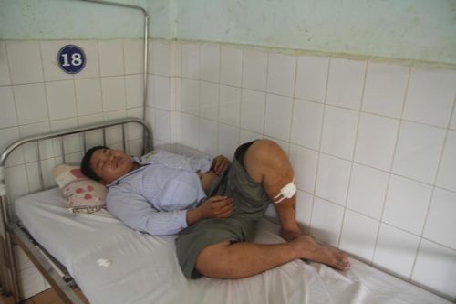 Nghi phạm chém 3 cảnh sát bị khởi tố