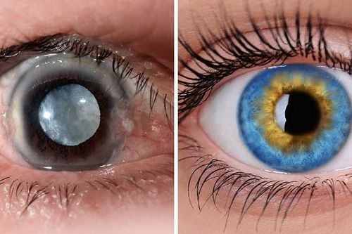 8 loại thực phẩm thông thường có tác dụng không ngờ trong việc chữa bệnh