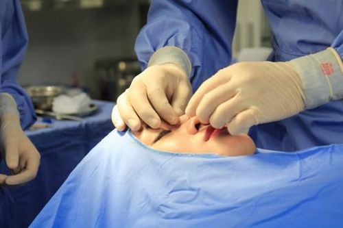 Phẫu thuật thẩm mỹ chui: Khi đi 'lộng lẫy' khi về… 'mất tiêu'