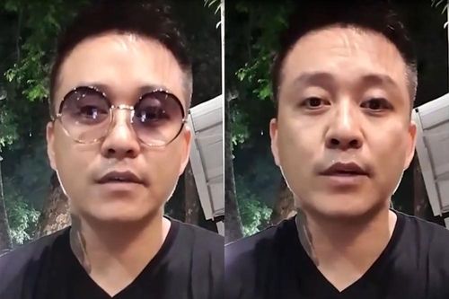Tuấn Hưng bị sút bóng vào mắt, thị lực suy giảm chỉ còn 4/10