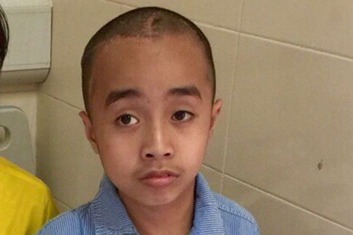 Sự sống mong manh của cậu bé 10 tuổi, 4 lần phẫu thuật u não