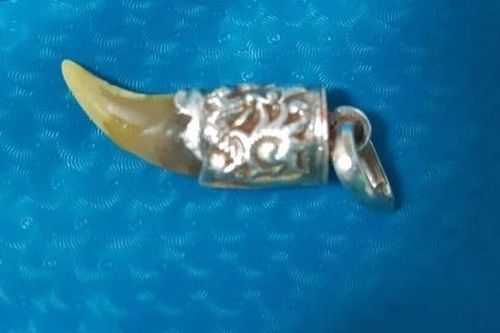 Chơi dây chuyền, bé 23 tháng tuổi nuốt nanh hổ vào bụng