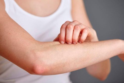 Cách nhận biết và sơ cứu khi bị dị ứng