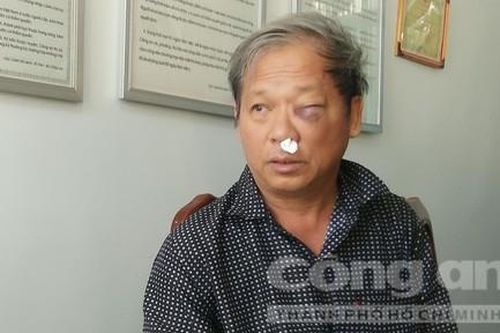 Phóng viên VTV bị côn đồ tới nhà dọa giết, đánh nhập viện