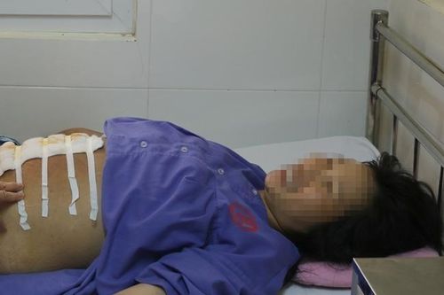 Sản phụ vỡ ối, thai nhi lọt tay ra ngoài