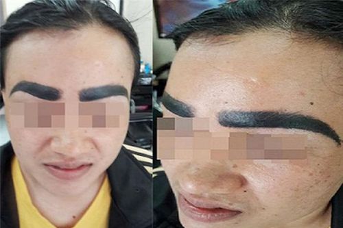 Xăm lông mày đón Tết, khổ chủ 'khóc ròng' vì giống đỉa trâu