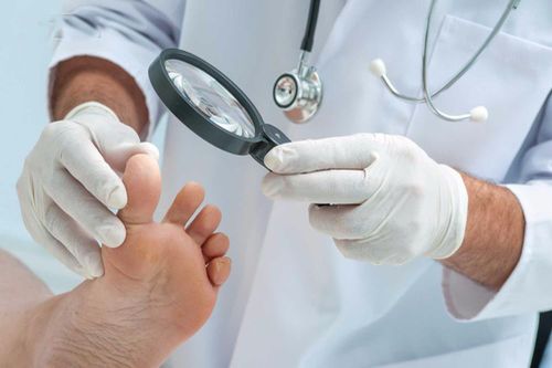 Nhận biết nhanh bệnh tiểu đường qua 5 dấu hiệu ở bàn chân