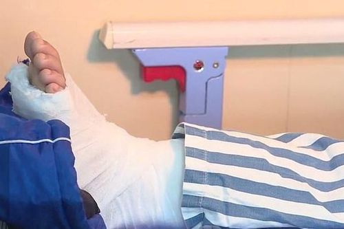 Không hoàn thành bài tập về nhà, bé trai bị bố đánh đập dã man