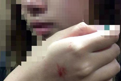 Người đàn ông sàm sỡ cô gái trong thang máy sẽ xin lỗi công khai