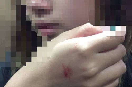 Cô gái bị sàm sỡ trong thang máy: 'Tôi rất thất vọng'