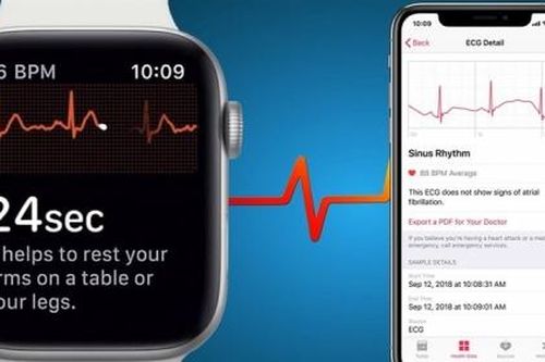 Tính năng đo điện tâm đồ trên Apple Watch bị giới hạn sử dụng tại Mỹ