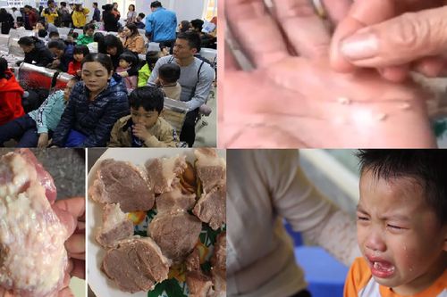 Hàng trăm trẻ bị nhiễm sán lợn ở Bắc Ninh được phát hiện thế nào?