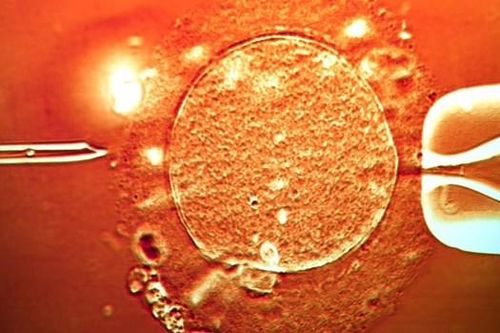 Hy Lạp chào đón em bé được sinh ra từ ADN của 3 người