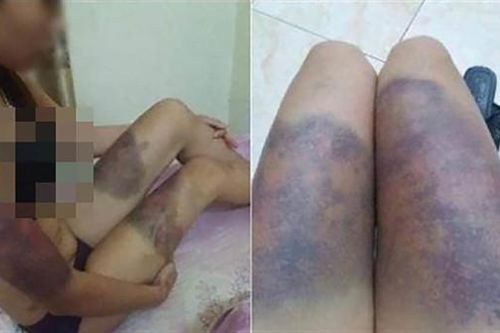 Thông tin mới nhất về nhóm đối tượng bắt, tra tấn cô gái 18 tuổi đến sảy thai