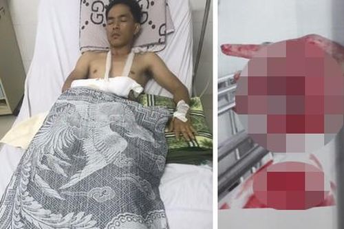 Nhóm 'giang hồ' dùng súng, mã tấu truy sát khiến 2 người bị thương ở quán cà phê