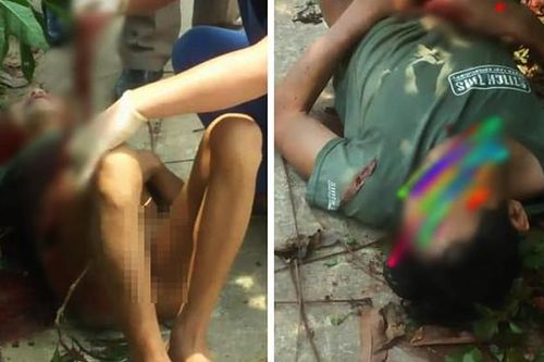 Người đàn ông tự cầm dao đâm thủng bụng mình giữa trưa nắng