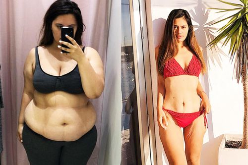 Giảm cân bằng việc cắt bỏ một phần dạ dày có hiệu quả?
