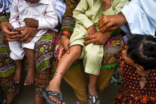 Pakistan: Một ngôi làng bỗng dưng có 700 người nhiễm HIV
