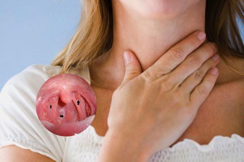 Dấu hiệu ung thư vòm họng chẳng mấy người để ý