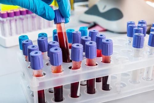 Vì sao AB là nhóm máu hiếm nhất thế giới?