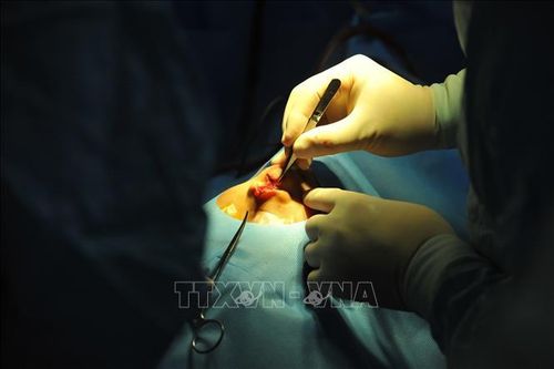Phẫu thuật thành công ca u hạch thần kinh hiếm gặp