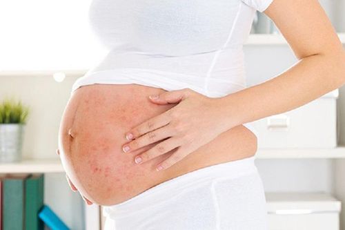 Người phụ nữ sinh 69 đứa con trong 76 năm