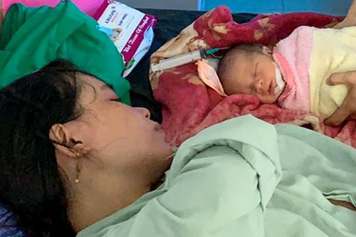 Mẹ suýt mất con vì thai ngôi ngược bị kẹt đầu bên trong khi sinh